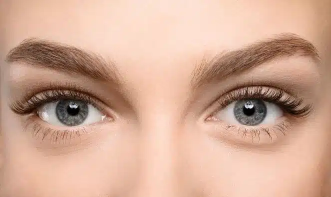 Browlift